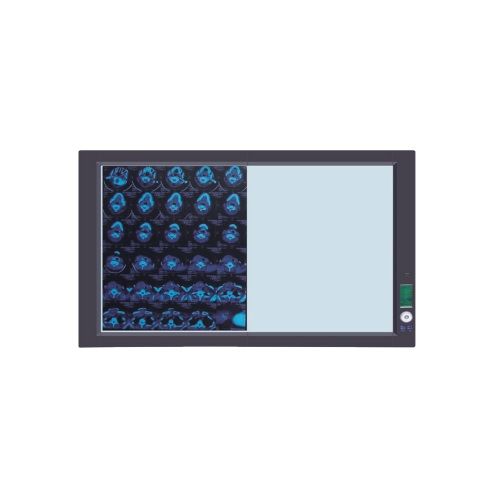 Negatoscopio sencillo de luz LED