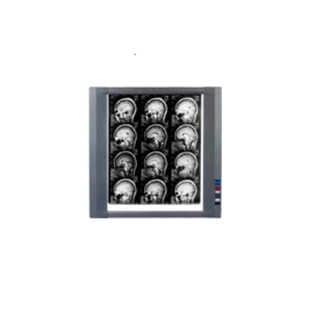 Negatoscopio sencillo de doble LED MSI de Beracah Médica con iluminación de 6500 K para diagnóstico médico.