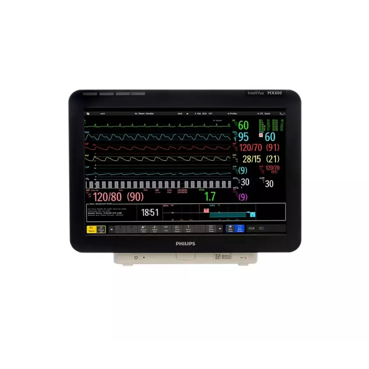 Monitor de signos vitales MX850 de Beracah Médica con rack para módulos e impresora, mostrando pantalla y conexiones.