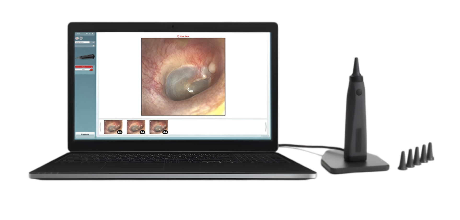 Otoscopio Viot™ de Beracah Medica mostrando la punta y lentes para inspección de oído en una imagen clara.