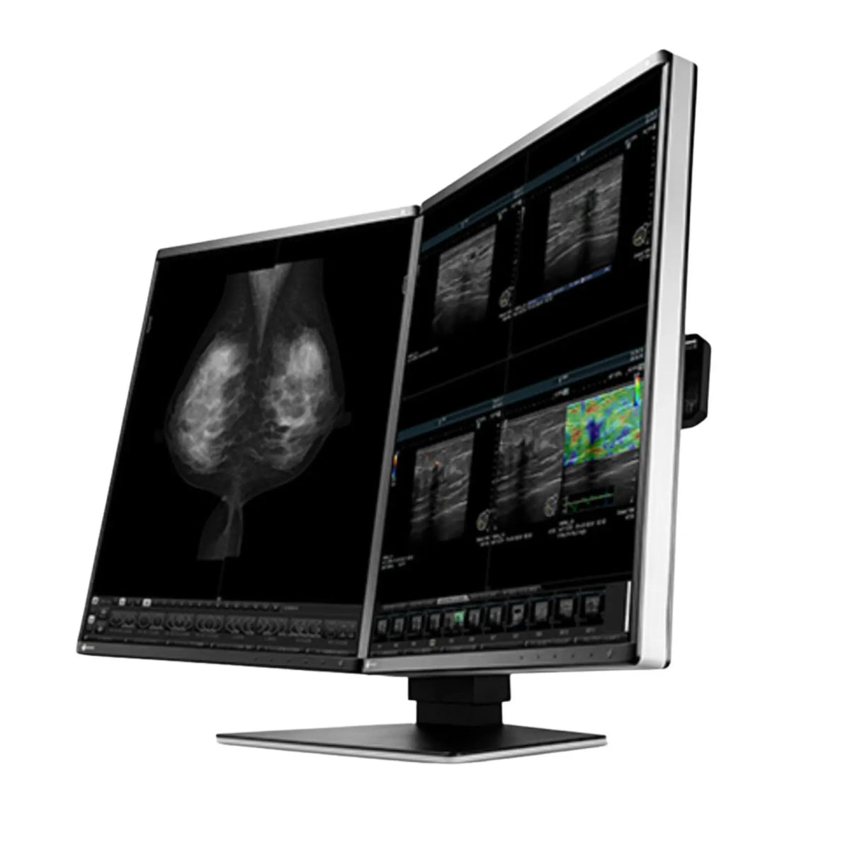 Monitor doble de diagnóstico Radiforce 5MP de 21.3" en color, resolución 2048 x 2560, para diagnóstico médico de Beracah Medica.