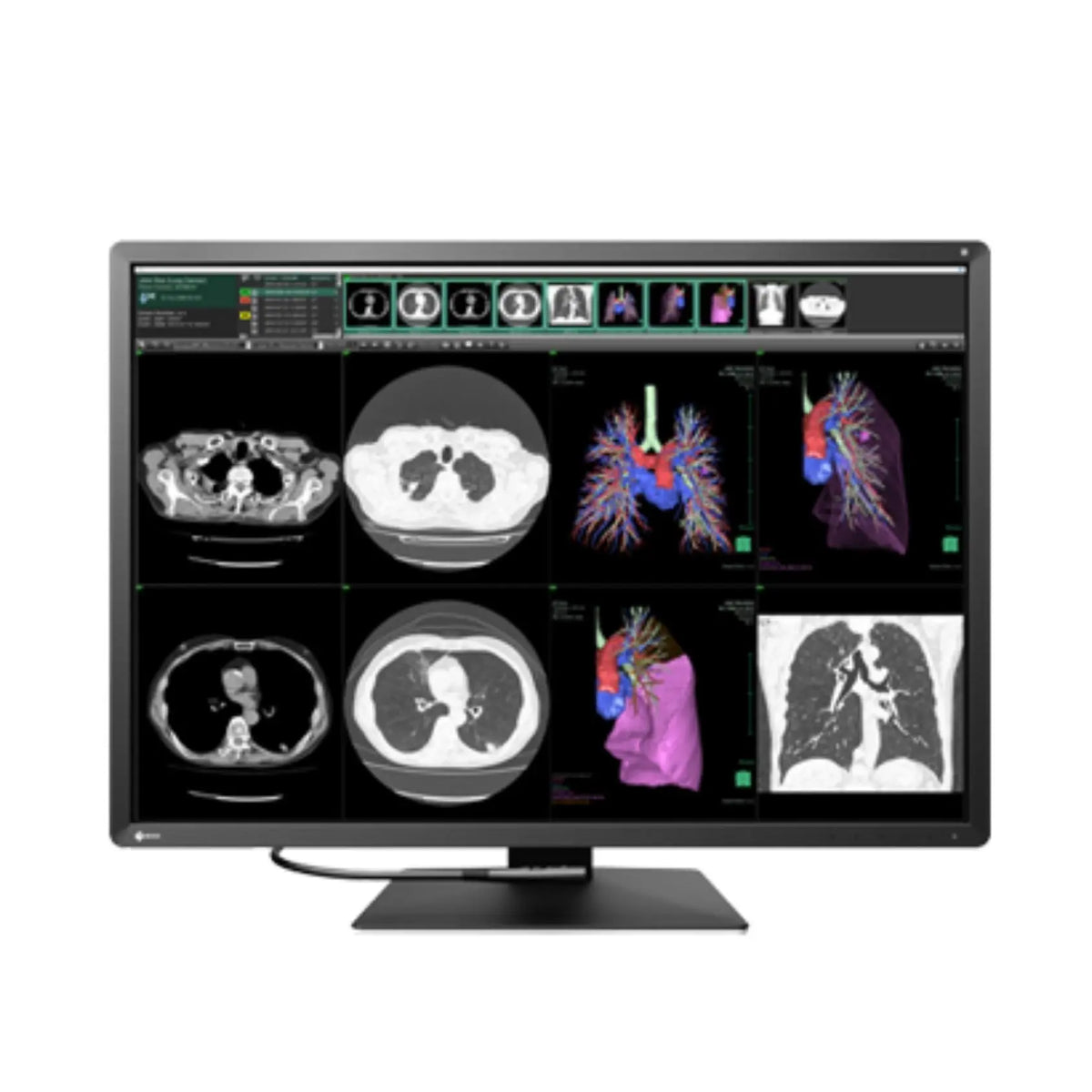 Monitor de diagnóstico Radiforce 12MP de 30.9" en color, marca Beracah Médica, resolución 4200 x 2800 para uso médico.
