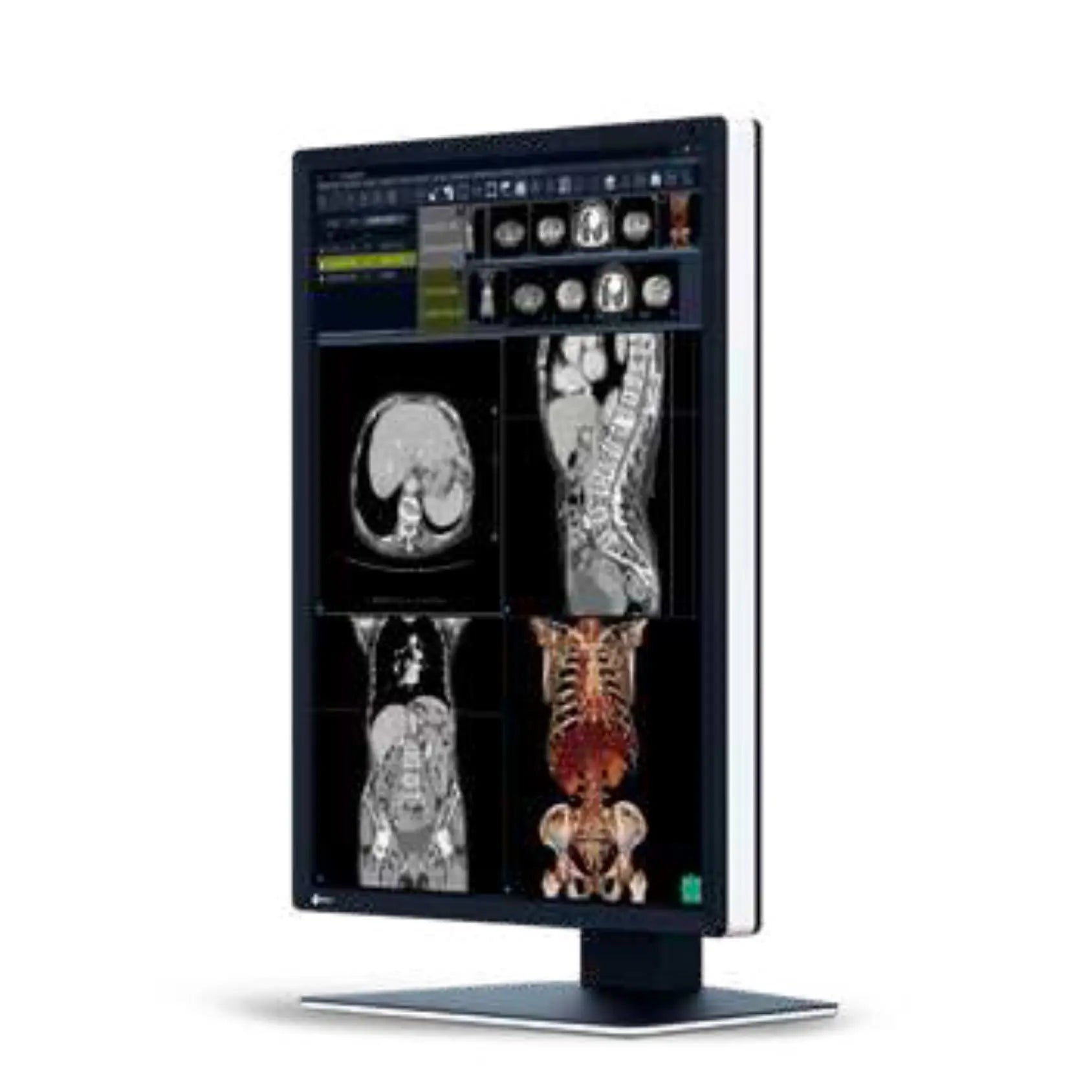 Monitor sencillo grado medico de DIAGNOSTICO RadiForce 2MP 21.3" Color, 1200x1600