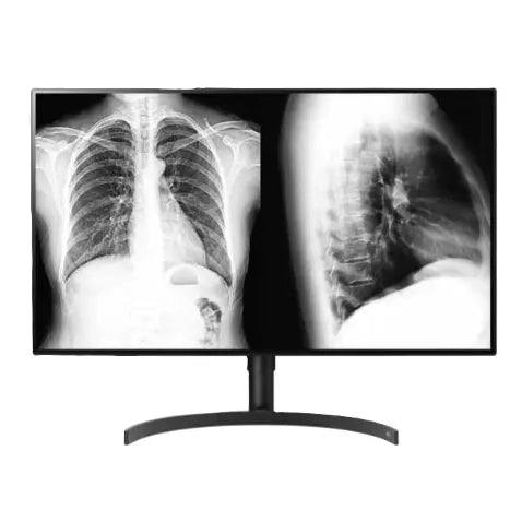 Monitor de diagnóstico médico Beracah Medica de 31.5 pulgadas con pantalla de 8MP para diagnóstico clínico.