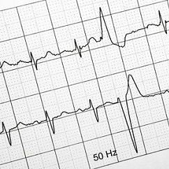 Papel para ECG en Z de 10x15cm de Beracah Medica, 180 hojas por caja, en 10 paquetes, ideal para registros médicos.