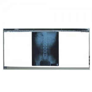 Negatoscopio triple MSI Mod. Avante de Beracah Medica con pantalla para visualización de radiografías médicas.
