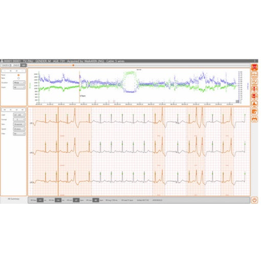 Software CubeHolter MSI de Beracah Medica para interpretación de estudios Holter en pantalla digital.