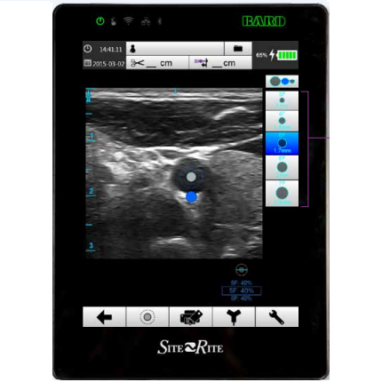 Ultrasonido portátil Beracah Medica Site Rite 8, dispositivo de ultrasonido ultraportátil con pantalla y controles.