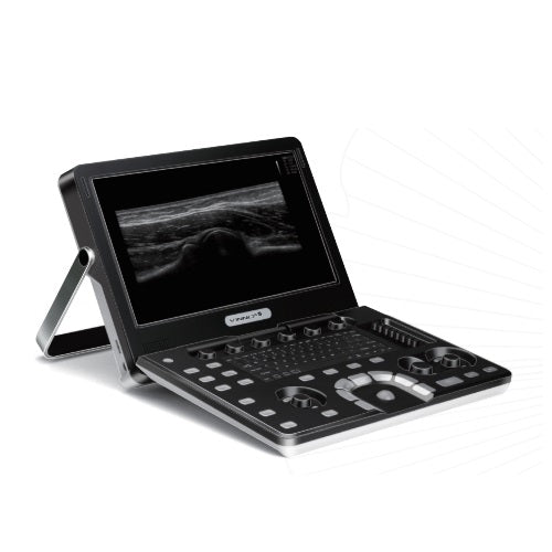 Ultrasonido portátil digital de 15" Beracah Medica con módulos ECG y CW para uso en cardiología, sin transductores.