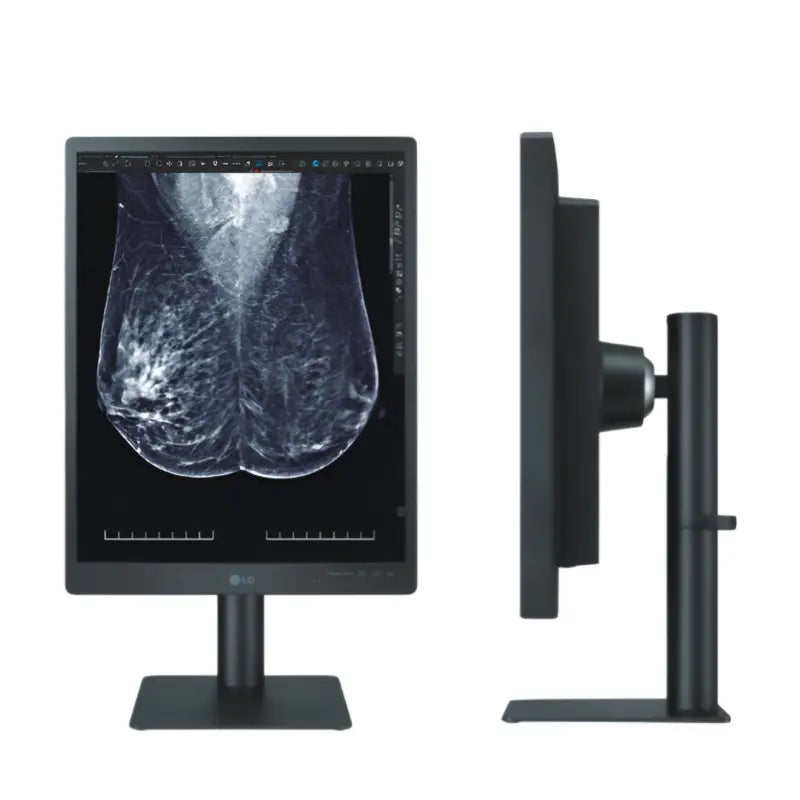 Monitor de diagnóstico médico Beracah Medica de 21.3 pulgadas con pantalla de 5MP para diagnóstico clínico.