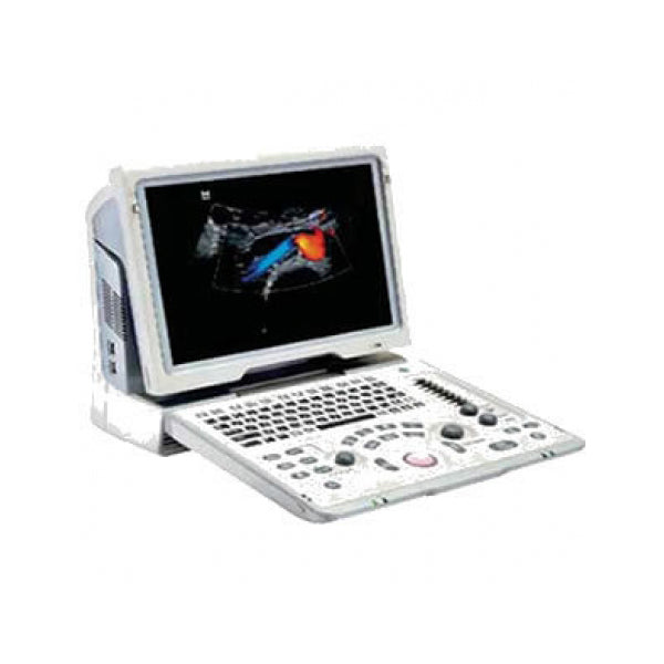 Ultrasonido portátil Doppler color 15" Beracah Medica con 3 transductores conv, lineal y endocavitario para diagnóstico médico.