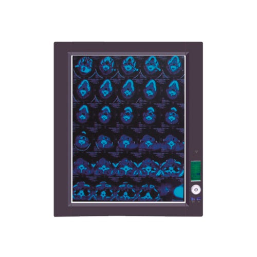 Negatoscopio sencillo MSI de luz LED de 8,000°K con marca Beracah Medica, mostrando pantalla y controles en la imagen