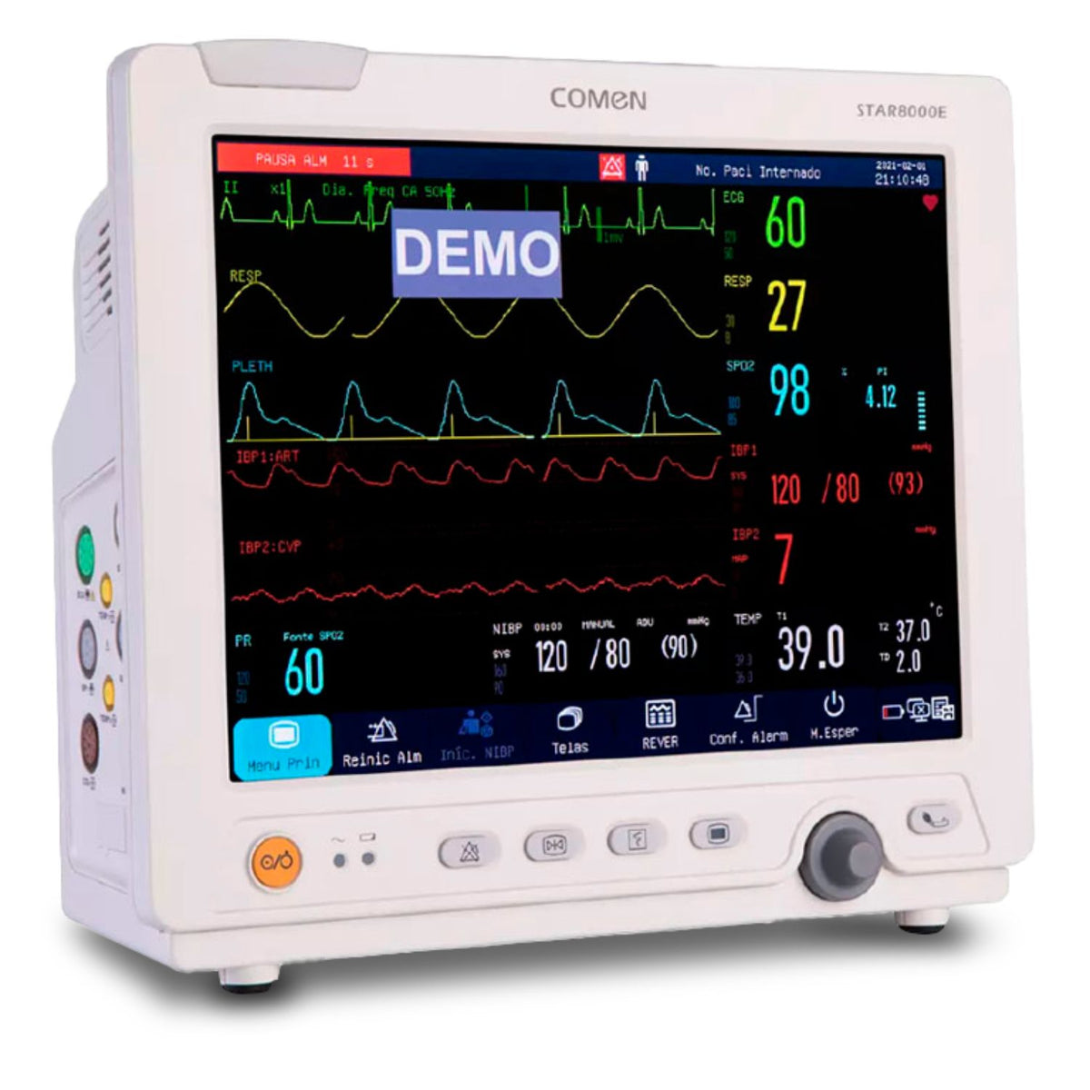 Monitor multiparámetro para paciente Beracah Medica STAR8000E de 12.1" con pantalla y seis parámetros visibles.