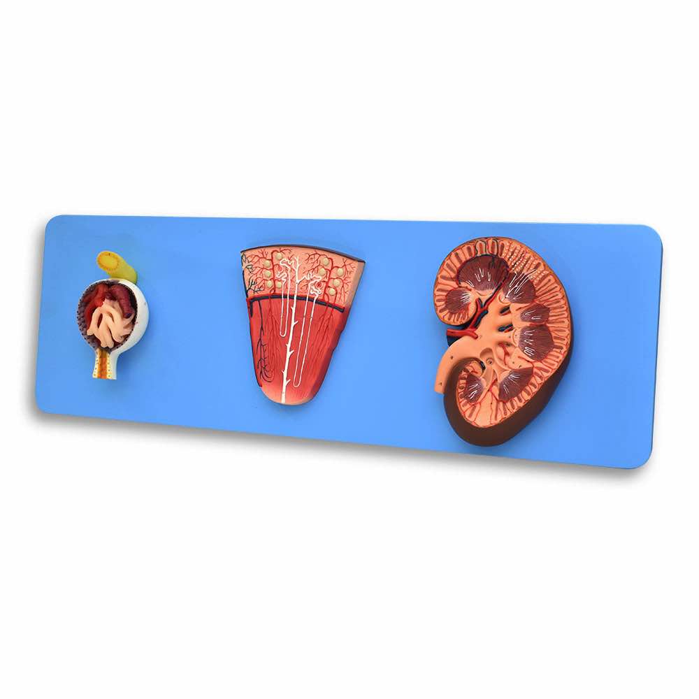 Riñón, nefrona y glomérulo en esquema del sistema urinario, imagen educativa de Beracah Medica