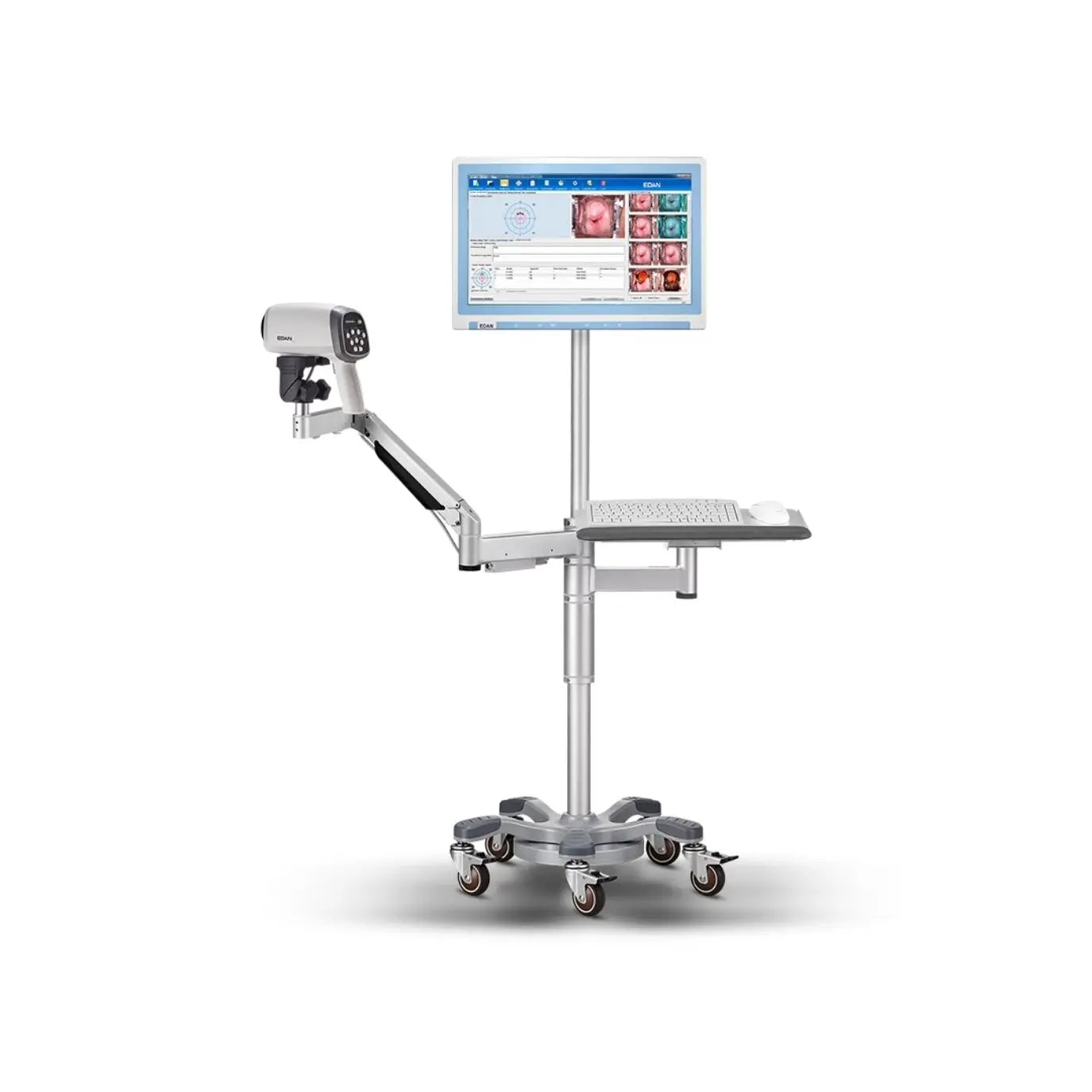 Colposcopio Beracah Medica C6A con pedestal articulado, software y bandeja para teclado, visible en la imagen.
