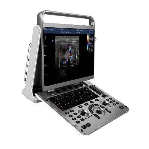Ultrasonido portátil Doppler de 15" Beracah Medica con transductor a escoger, equipo de diagnóstico médico compacto y avanzado.