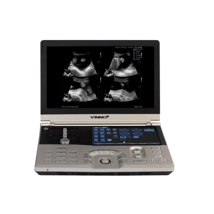 Ultrasonido portátil Beracah Médica de 15" color VINNO 6 con módulos ECG y CW para cardiología, pantalla y controles visibles.