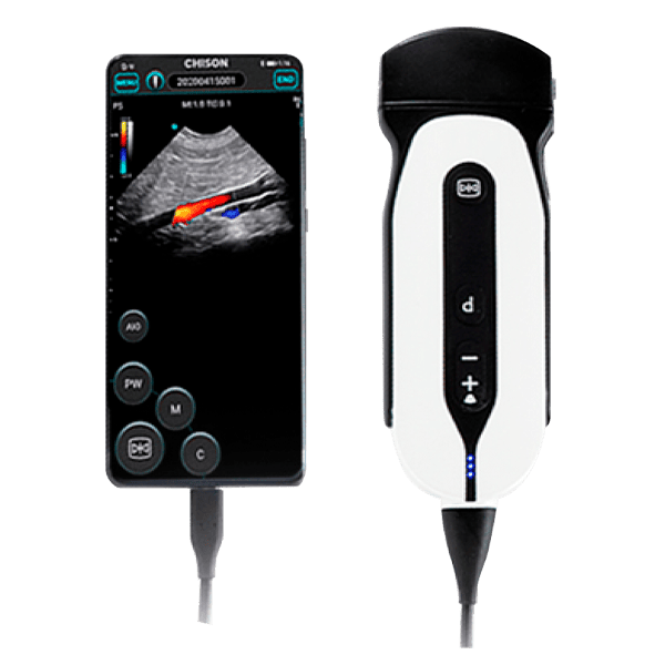 Ultrasonido de mano Sonoeye P5 convexo portátil de Beracah Medica, muestra pantalla y controles en un dispositivo compacto.
