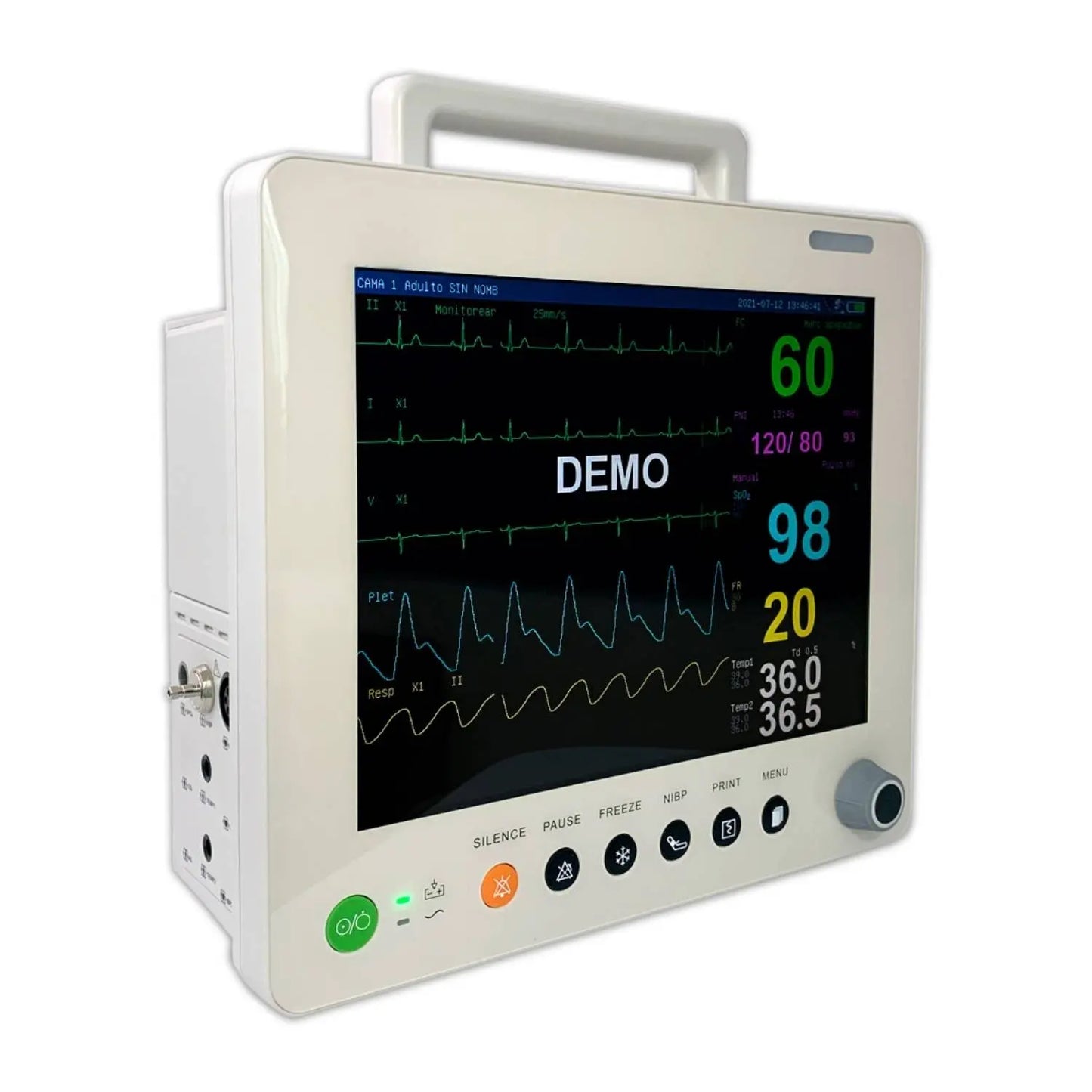 Monitor para paciente de 12 pulgadas MSI de Beracah Medica con multiparámetros, pantalla colorida y controles laterales.