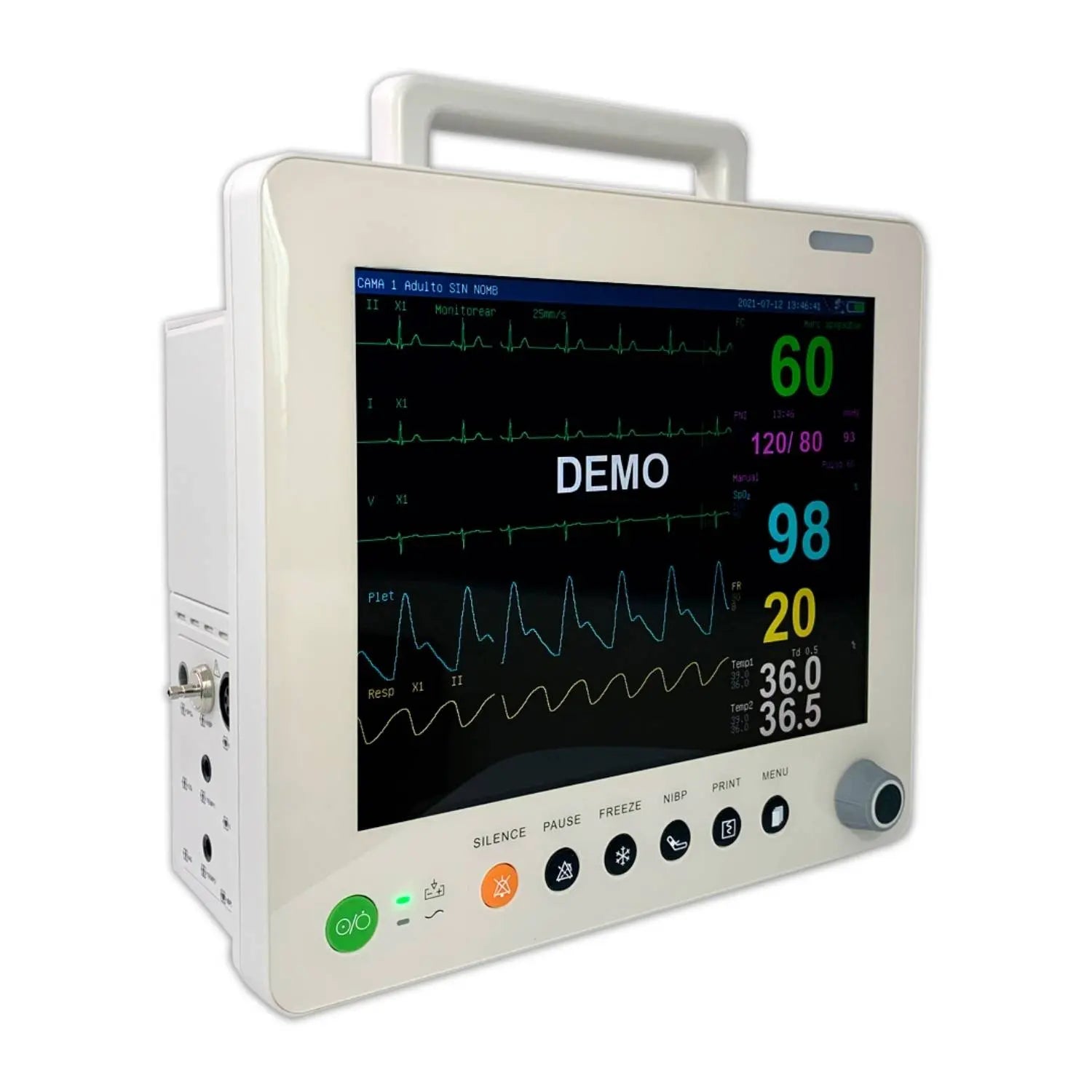 Monitor para paciente de 12 pulgadas MSI de Beracah Medica con multiparámetros, pantalla colorida y controles laterales.