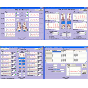 Software V-Link O Fetal Link para PC Windows, interfaz MSI de Beracah Medica para doppler ES100V3, SD30, SD50.