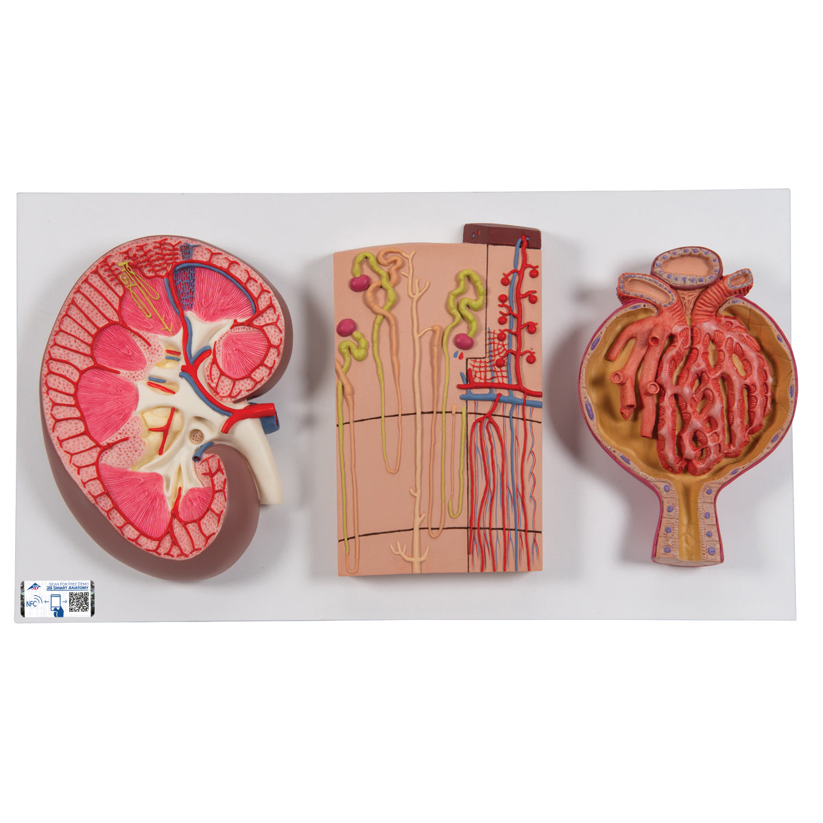 Riñón, nefrón, conductos sanguíneos y corpúsculo renal en sistema urinario, imagen de Beracah Médica