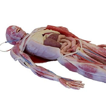 Simulador quirúrgico Syndaver de cuerpo completo masculino para entrenamiento médico, fabricado por Beracah Medica.