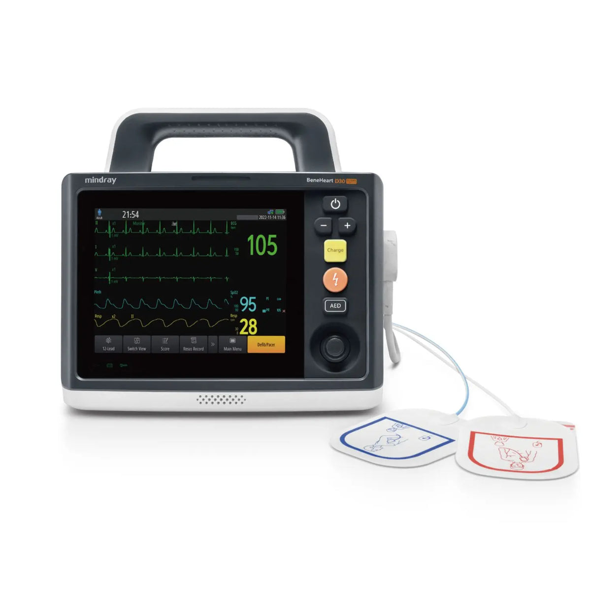 Desfibrilador monitor adulto-pediátrico BeneHeart D30 de Beracah Medica con pantalla, ECG, SPO2 y PANI en uso.
