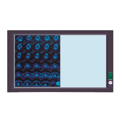 Negatoscopio doble de luz LED MSI de 8,000°K de Beracah Medica, mostrando la pantalla y controles del dispositivo médico