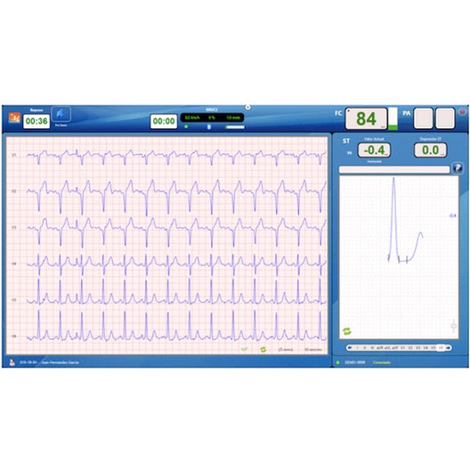 Programa CardioSW de Beracah Medica para pruebas de esfuerzo en equipos CV200 y CV1200, muestra la interfaz en pantalla.