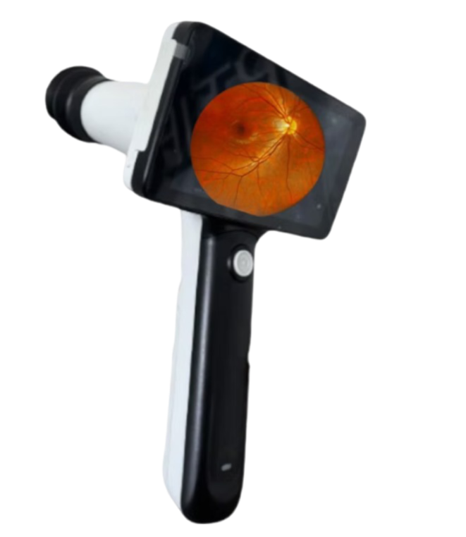 Camara retinal portatil Mod. CFC-S