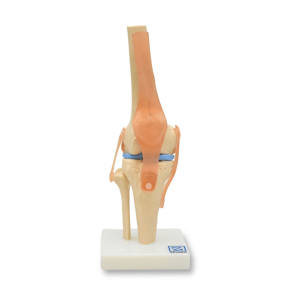 Sistema óseo de articulación de la rodilla de la marca Beracah Medica, vista detallada en imagen.
