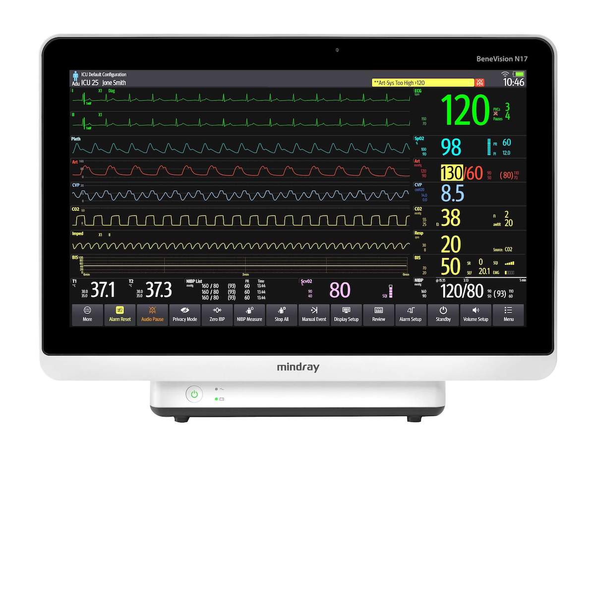 Monitor para paciente Benevision N12 de Beracah Médica con pantalla de 12.1 pulgadas para signos vitales y monitoreo de 6 parámetros.