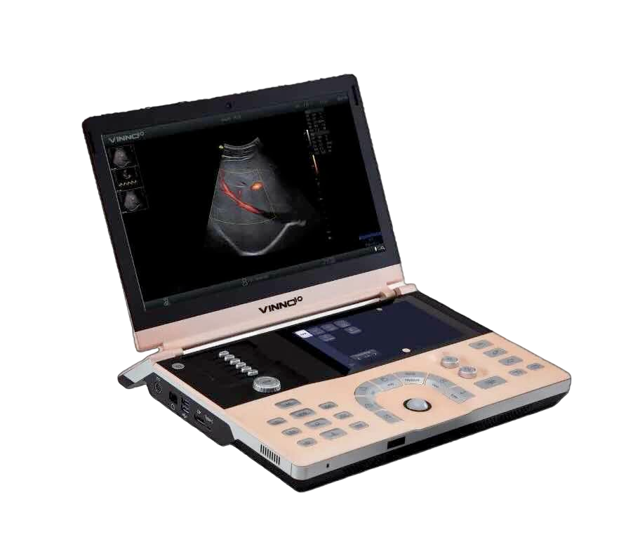 Ultrasonido ecógrafo portátil Beracah Medica Vinno 10 sin transductores, pantalla y controles en el dispositivo.