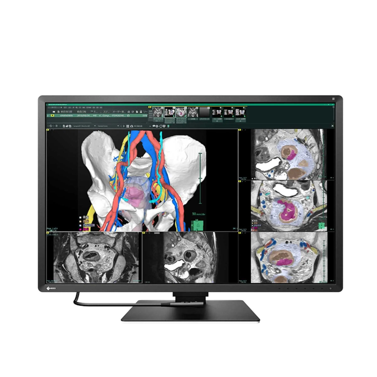 Monitor médico Radiforce de 30" en color, 6MP para diagnóstico, resolución 3280x2048, ideal para monitores de diagnóstico Beracah Medica.