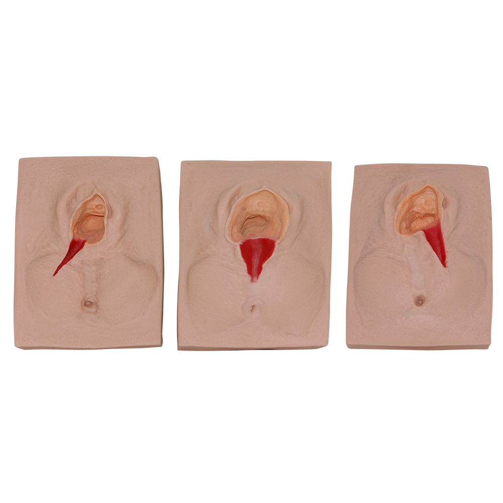 Simulador de episiotomía y sutura de Beracah Medica para entrenamiento en procedimientos médicos, con detalles realistas en la piel.