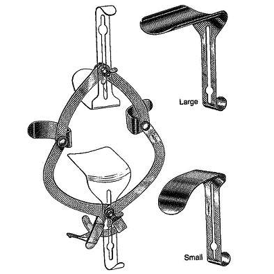Separador o retractor abdominal O'Sullivan O'Connor de Beracah Medica, muestra el dispositivo médico en uso en un entorno clínico.