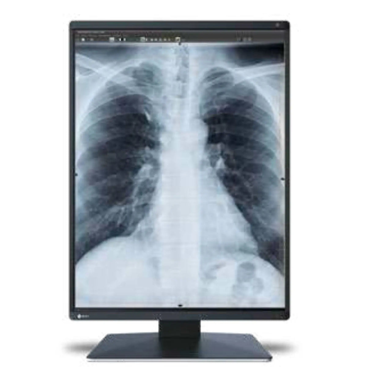 Monitor médico Radiforce 3MP de 21.3 pulgadas en color, con resolución 1536x2048 para diagnóstico clínico, marca Beracah Medica.