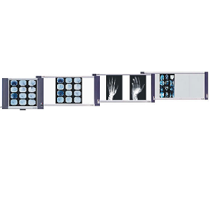 Negatoscopio LED ultradelgado MSI Beracah Medica con 6,500 Lux y luz de 10,000°K, pantalla clara y diseño compacto.