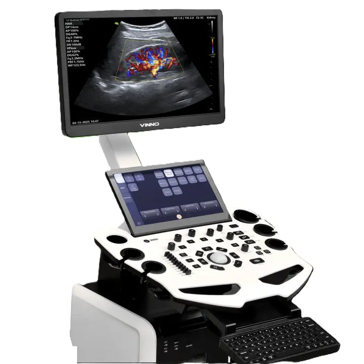 Ultrasonido de gabinete Beracah Medica con monitor de 21.5” y panel táctil de 13.3” para diagnóstico médico.