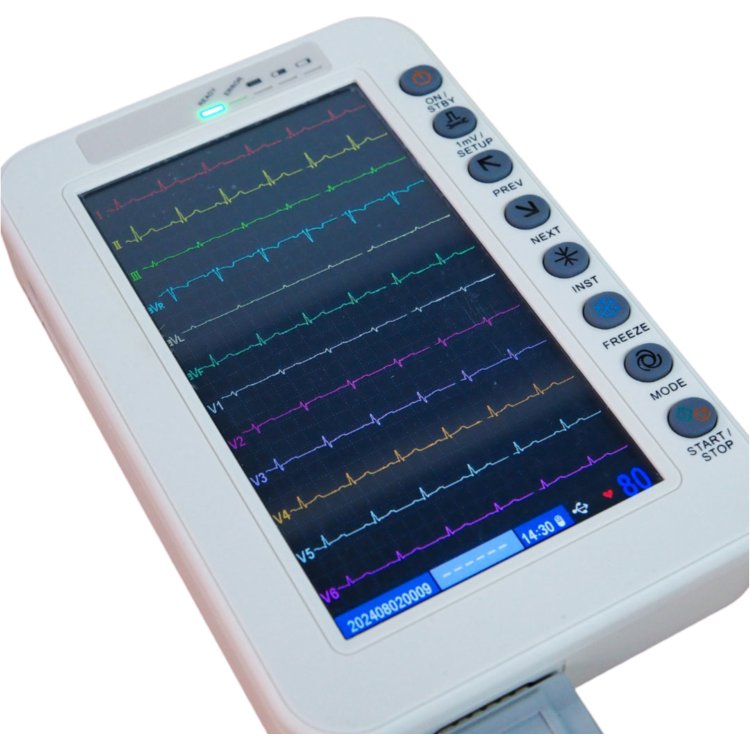 Electrocardiógrafo portátil de 12 canales Beracah Medica con pantalla táctil de 7 pulgadas para monitoreo de ECG.