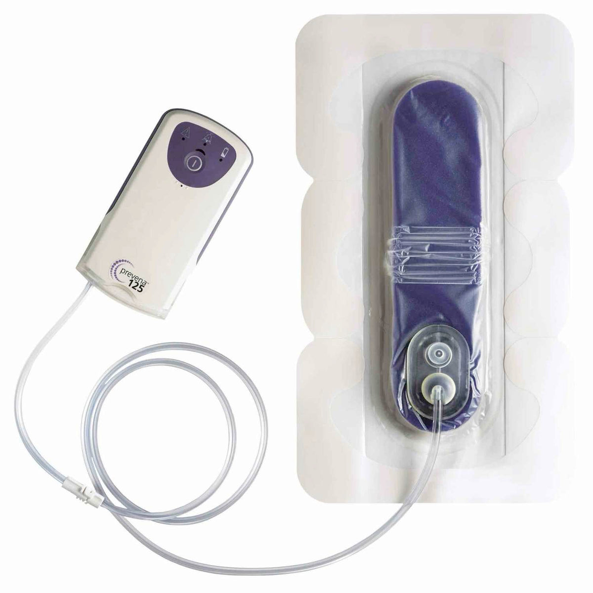 Gasas y apósitos para heridas PREVENA PEEL & PLACE™ de Beracah Medica, kit de 20 cm con bomba de 7 días.