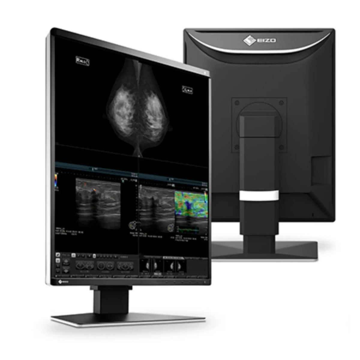 Monitor médico de diagnóstico Radiforce 5MP de 21.3 pulgadas en color, resolución 2048 x 2560, para diagnóstico médico.