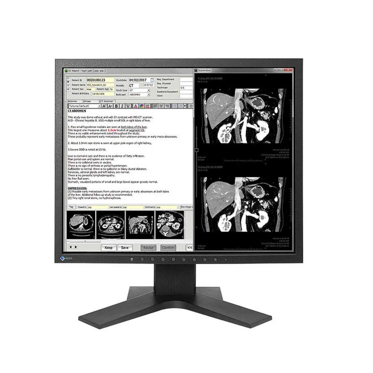Monitor Sencillo de Revisión Clínica Radiforce 1.3MP, de 19", Color, 1280 x 1024