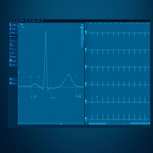 Licencia CardioPoint C600 de Beracah Medica, software avanzado para conectar electrocardiógrafos BTL a PC.