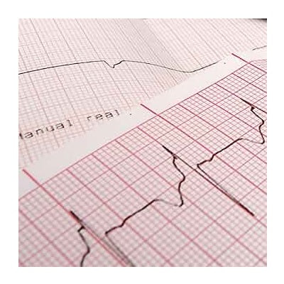 Papel para ECG en Z Beracah Médica, 21 x 29.5 cm, paquete con 10 piezas, ideal para registros electrocardiográficos.