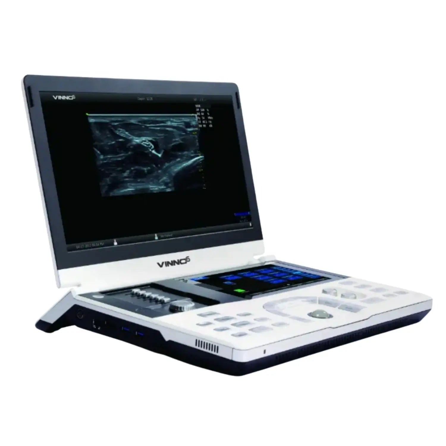 Imagen de un ultrasonido Vinno 6 de la marca Beracah Medica, mostrando su pantalla y controles en un entorno clínico.