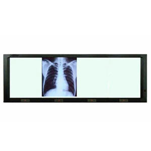 Negatoscopio cuádruple de pared con luz LED de 10,000 luxes y temperatura de color 9600°K, marca Beracah Medica.