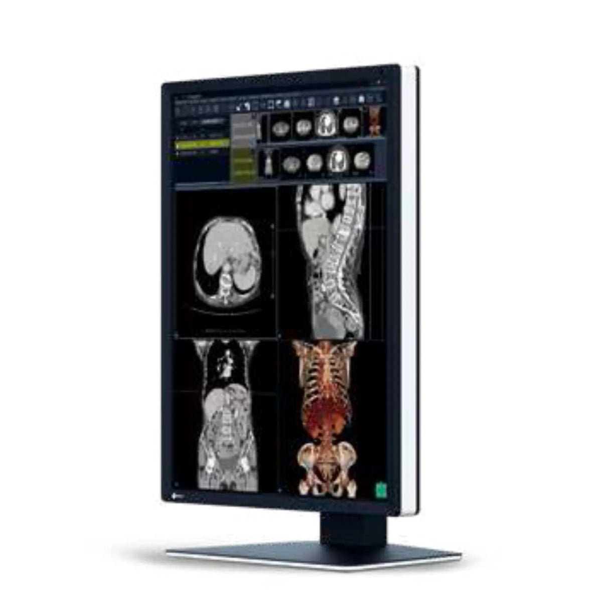 Monitor médico de diagnóstico RadiForce 2MP de 21.3 pulgadas en color, con resolución 1200x1600, de Beracah Médica.