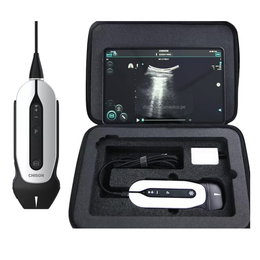 Ultrasonido de mano Sonoeye P1 Lineal de Beracah Medica, dispositivo portátil para imágenes médicas de ultrasonido.